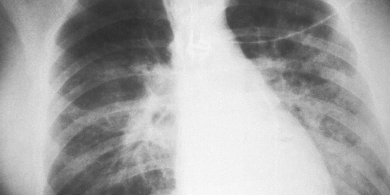 How does air affect health